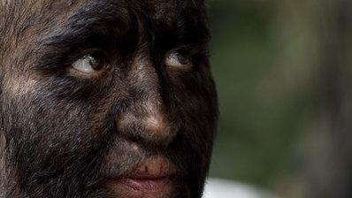 Mexique : l'homme loup-garou assume son visage recouvert de poils